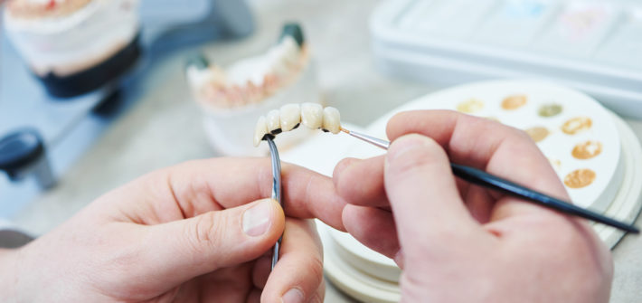 protèse dentaire